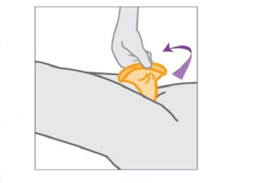 Hướng dẫn sử dụng bao cao su đúng cách cho nữ giới