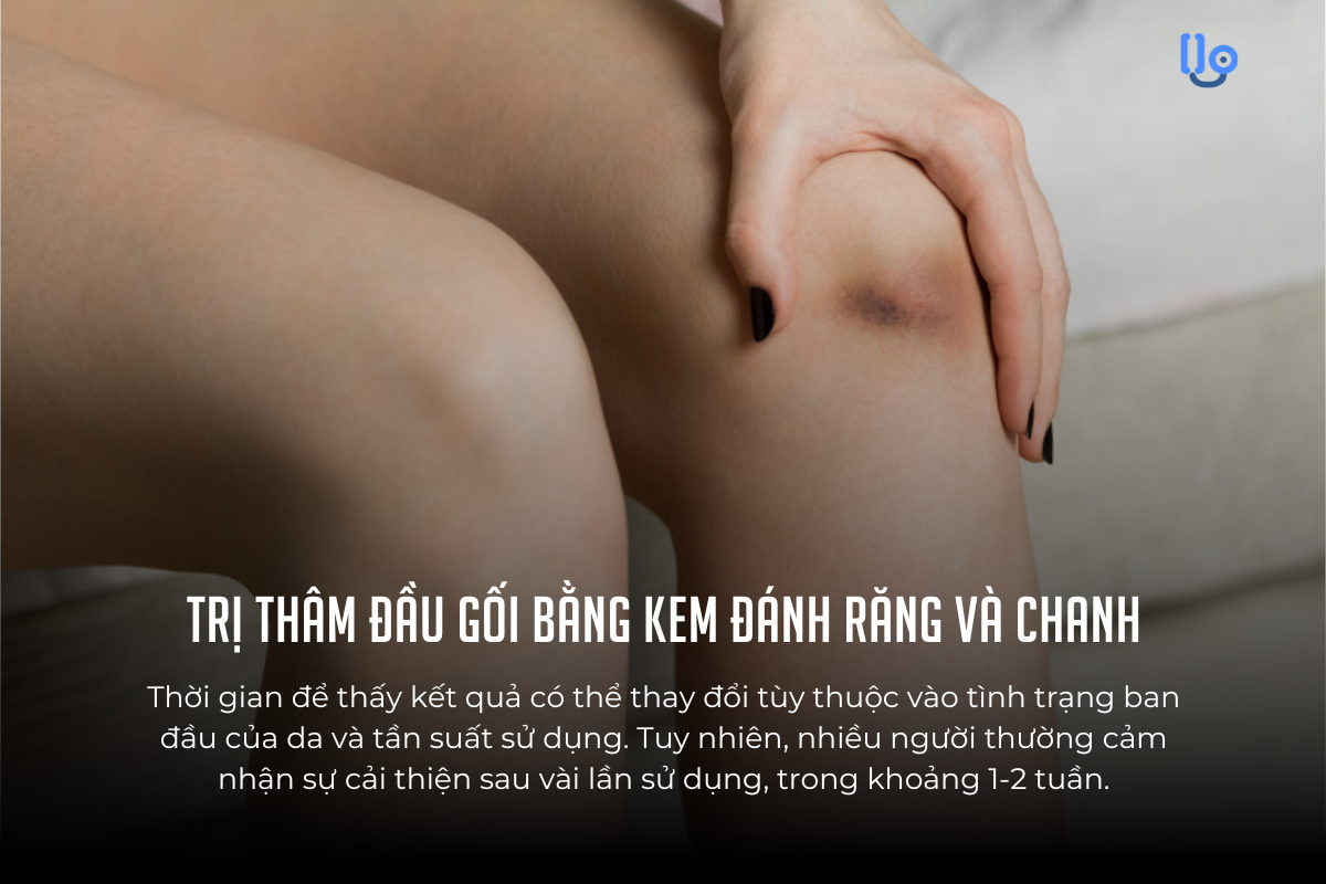 Cách trị thâm đầu gối bằng kem đánh răng và chanh: Dễ làm, tiết kiệm, hiệu quả cao