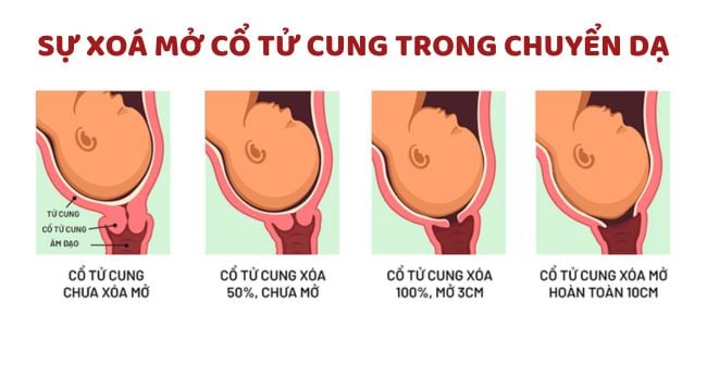 Đau bụng chuyển dạ như thế nào, ở vị trí nào & Dấu hiệu đau đẻ