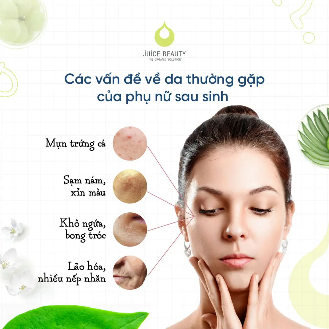 Mẹ cho con bú dùng kem dưỡng da mặt được không?