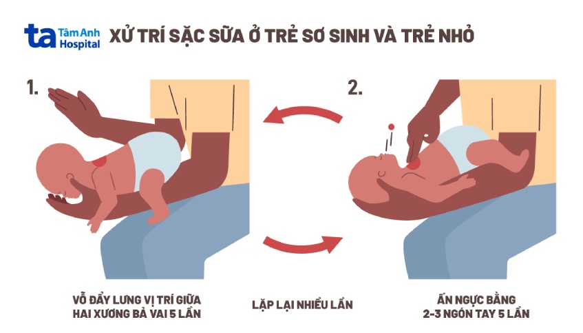 Tư thế cho bé bú bình đúng cách không sặc sữa các mẹ nên biết