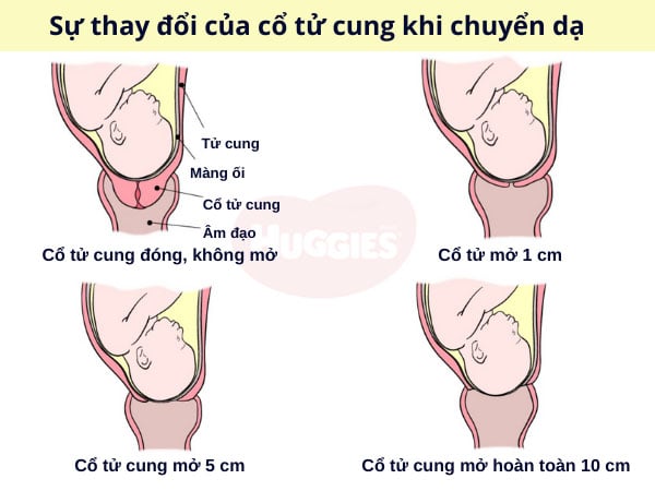 11 dấu hiệu sắp sinh (chuyển dạ) của mẹ bầu trước 1, 2 ngày và 1 tuần