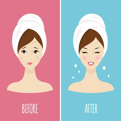 AHA và tác dụng tuyệt vời cho làn da của các tín đồ skincare