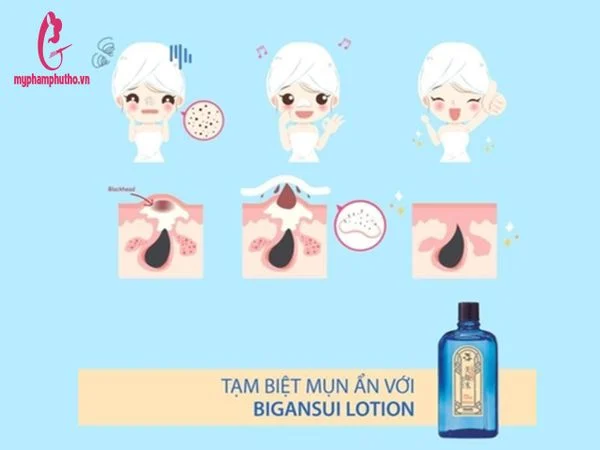 Nước hoa hồng trị mụn Meishoku Toner Nhật Bản