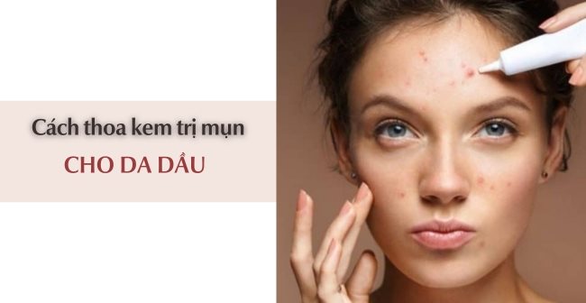 Top 3 kem trị mụn cho da dầu hiệu quả tốt nhất hiện nay