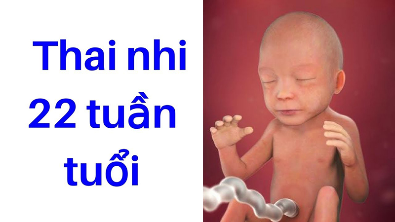 Xét nghiệm thai 22 tuần tuổi thời điểm vàng khảo sát dị tật thai nhi