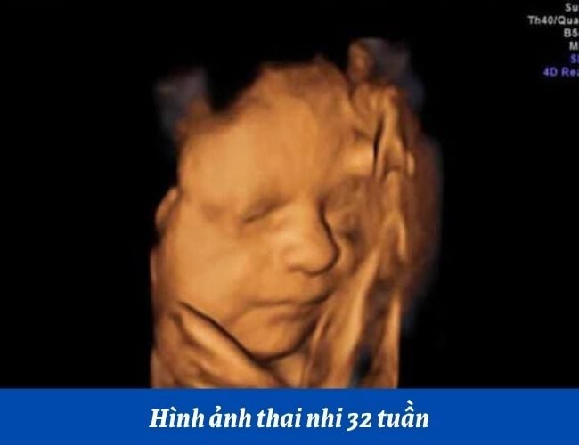 Khi thai nhi 32 tuần tuổi, mẹ bầu cần chú ý và chuẩn bị những gì?