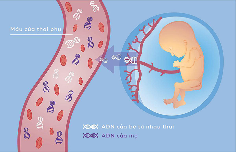 Xét nghiệm NIPT là gì và những ưu điểm khi thực hiện