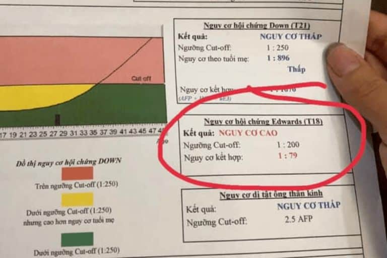 Xét Nghiệm NIPT Có Biết Được Trai Hay Gái Không?