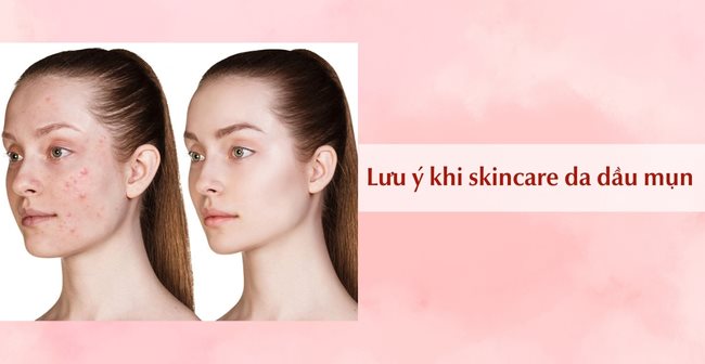 Quy Trình Các Bước Skincare Cho Da Dầu Mụn Ngày & Đêm Chuẩn