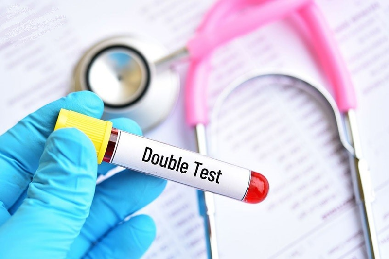 Xét nghiệm Double Test hết bao nhiêu tiền và quy trình ra sao?