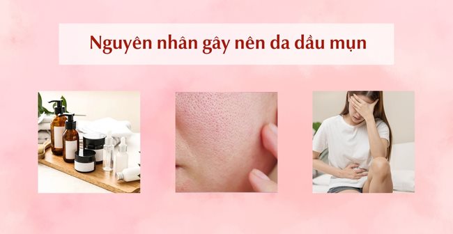 Quy Trình Các Bước Skincare Cho Da Dầu Mụn Ngày & Đêm Chuẩn