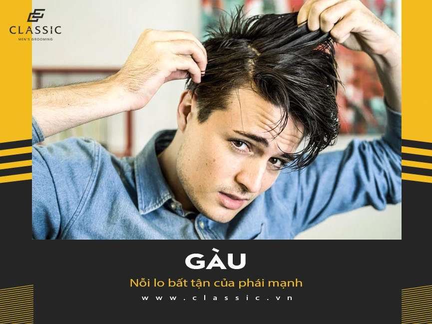 Top 5 chai dầu gội trị gàu cho nam giới tốt nhất hiện nay