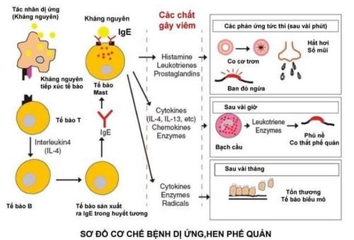 Bệnh hen suyễn: Những điều cần biết