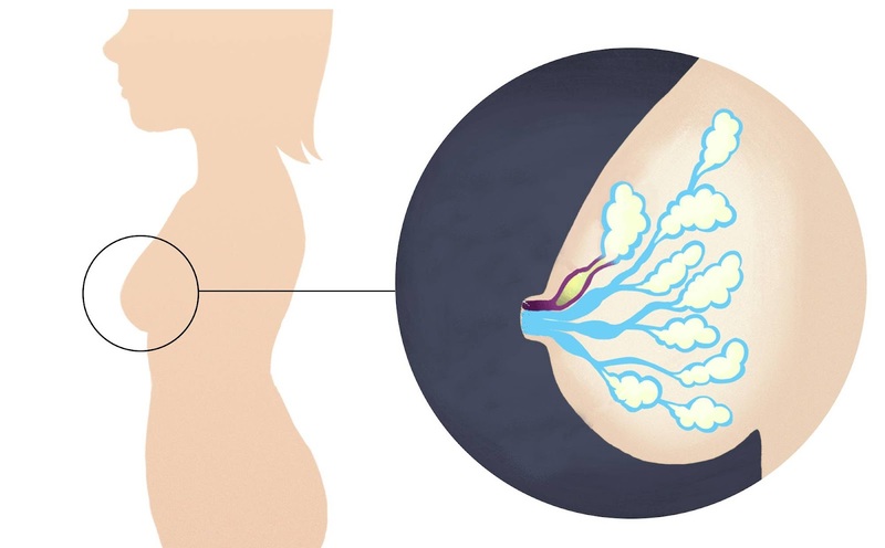 Nguyên nhân dẫn đến tắc tia sữa và cách chữa tắc tia sữa khoa học