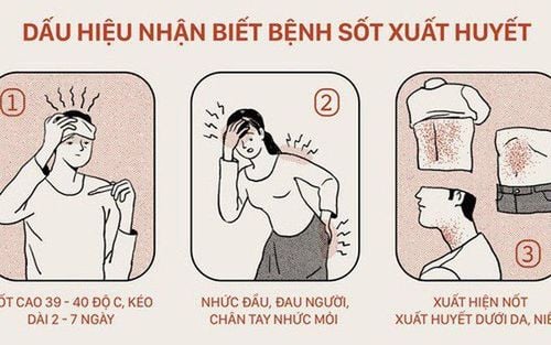 3 giai đoạn phát triển của bệnh sốt xuất huyết