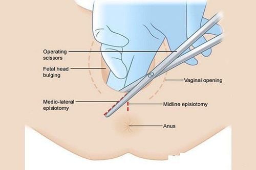 5 điều chị em nên biết về tầng sinh môn