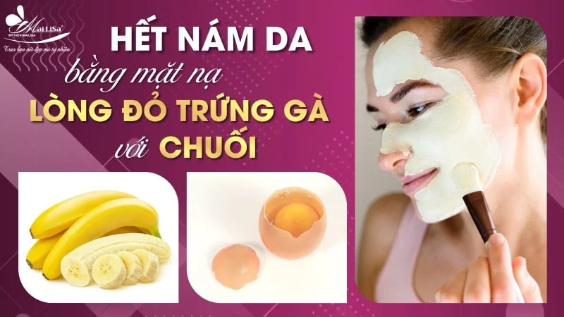 Tips làm mặt nạ lòng đỏ trứng gà trị nám da