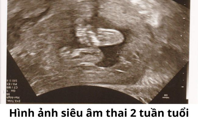 10+ dấu hiệu có thai 2 tuần quan hệ thường gặp ở các mẹ bầu