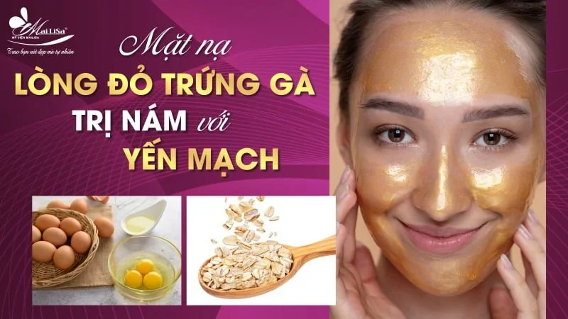 Tips làm mặt nạ lòng đỏ trứng gà trị nám da