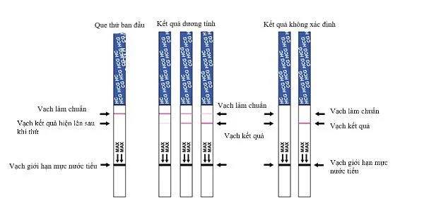 Cách dùng que thử thai và đọc kết quả que thử thai theo hướng dẫn từ bác sĩ sản khoa