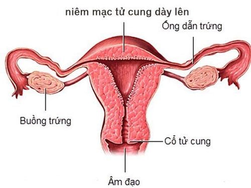 Niêm mạc tử cung bao nhiêu là bình thường?