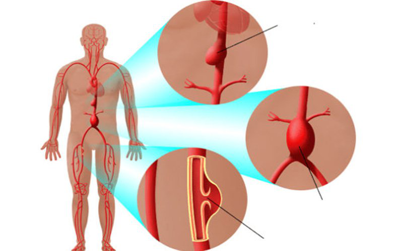 Bụng có nhịp đập có phải hiện tượng bất thường?