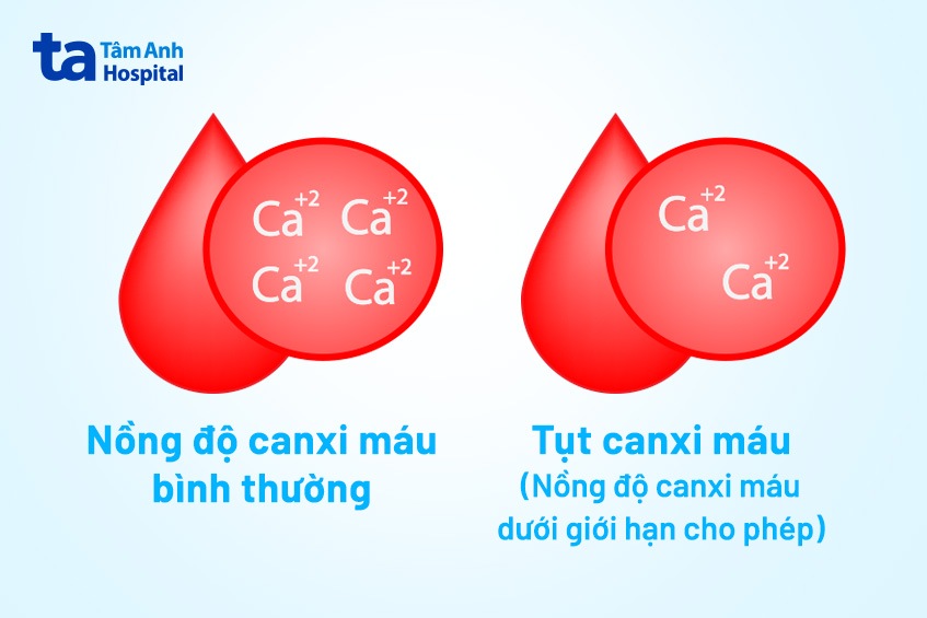 21 triệu chứng tụt canxi máu thường gặp, dễ nhận biết