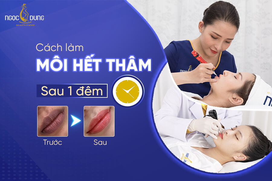 12 Cách làm môi hết thâm sau 1 đêm không phải ai cũng biết