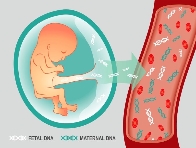 Làm xét nghiệm NIPT là gì và những điều cần biết