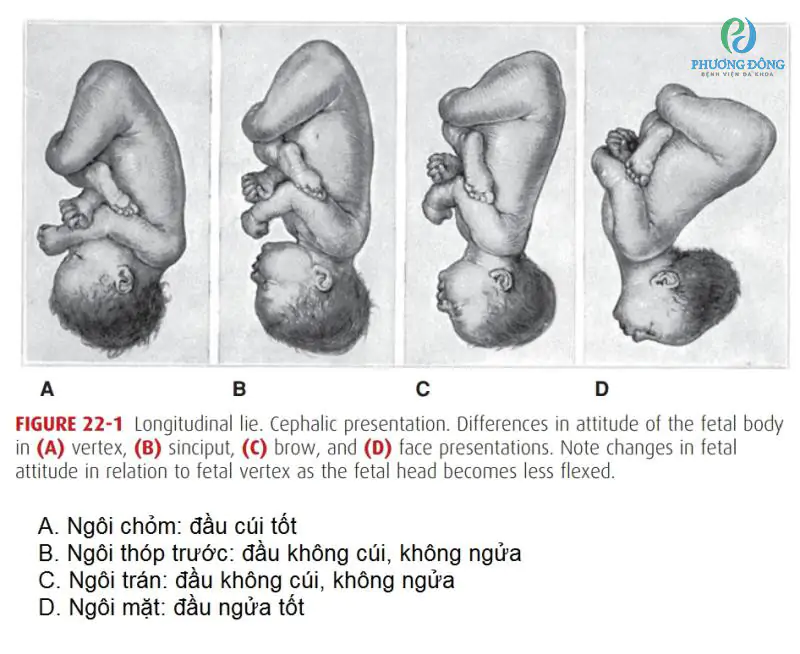 [Giải đáp] Ra nước ối mà chưa đau đẻ có đáng ngại không?