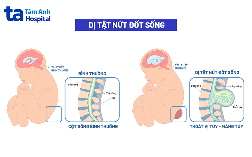 Bổ sung acid folic cho bà bầu bao nhiêu là đủ? Khi nào cần uống?