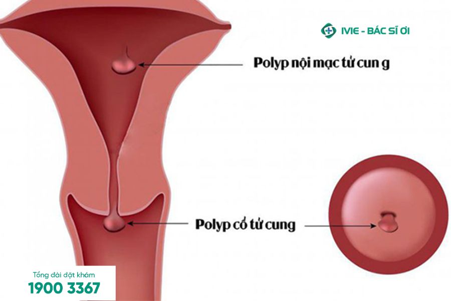 Sau quan hệ 1 ngày ra máu hồng có sao không? Cách xử lý kịp thời