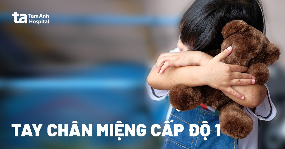 Bệnh tay chân miệng cấp độ 1: Triệu chứng và cách điều trị