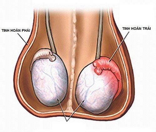 Bệnh quai bị gây sưng đau những vùng nào?