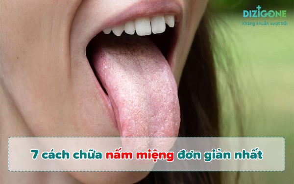 7 cách chữa nấm miệng tại nhà đơn giản nhất