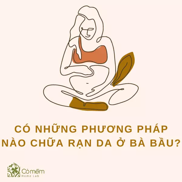 05 Kem trị rạn da cho bà bầu & bí quyết trị rạn da hay nhất