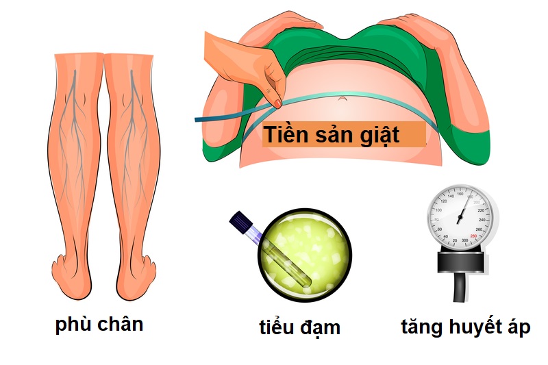 Những dấu hiệu tiền sản giật mẹ bầu cần ghi nhớ