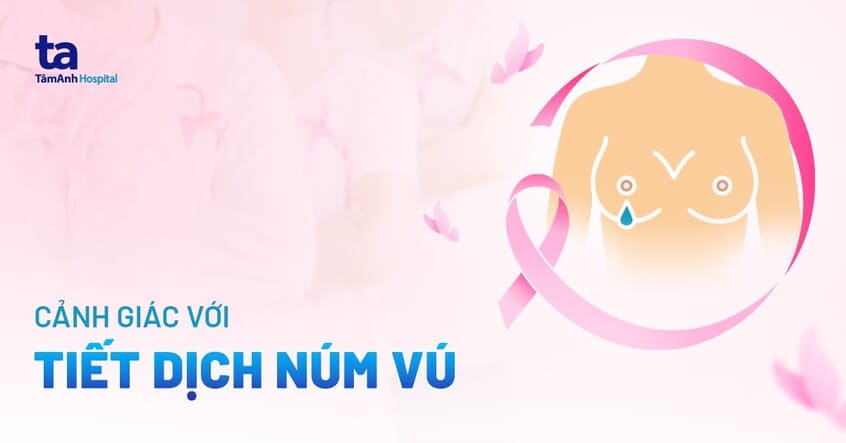 Tiết dịch núm vú (trắng trong/đục): Nguyên nhân và dấu hiệu