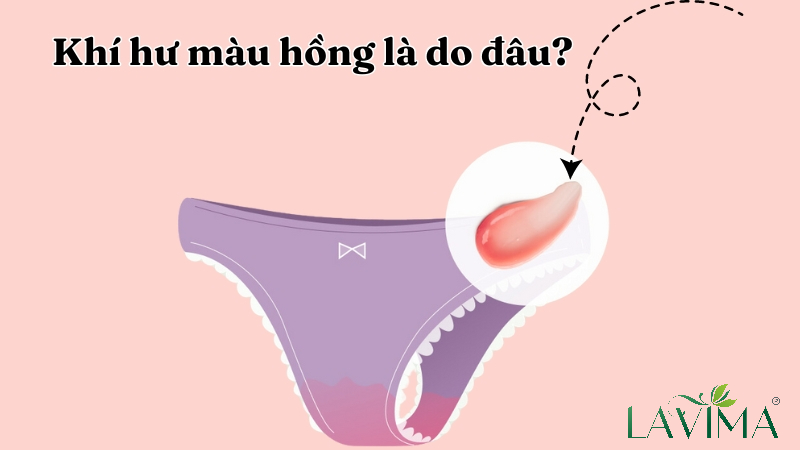 Khí hư màu hồng là do đâu? Cảnh báo bệnh gì và có nguy hiểm không? 