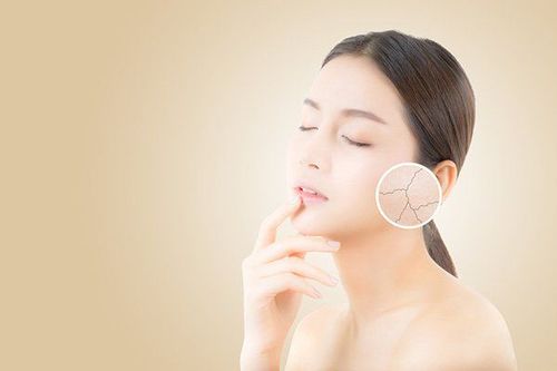 Retinoids cho da chống lão hóa