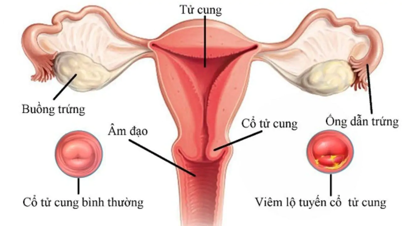 Tất tần tật những điều chị em muốn biết về siêu âm tử cung