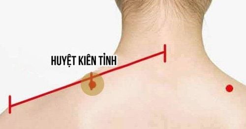 Tác dụng của huyệt kiên tỉnh