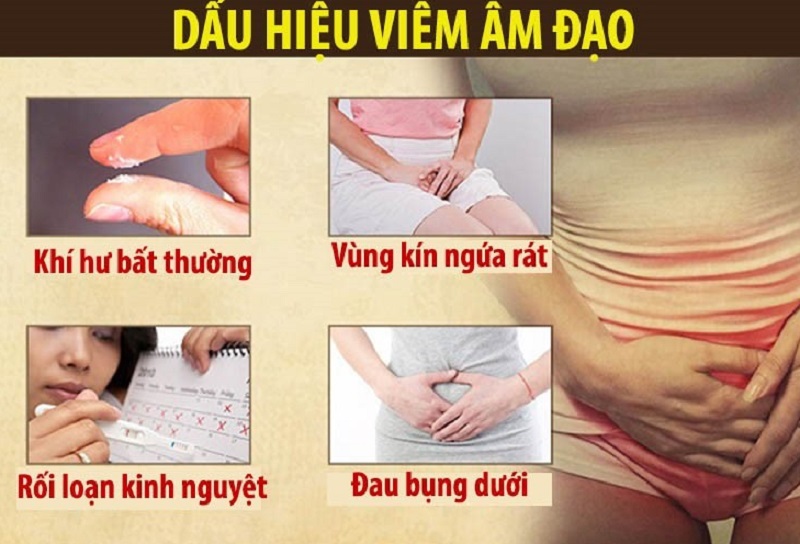 Nữ giới bị viêm âm đạo dùng thuốc gì là tốt nhất?