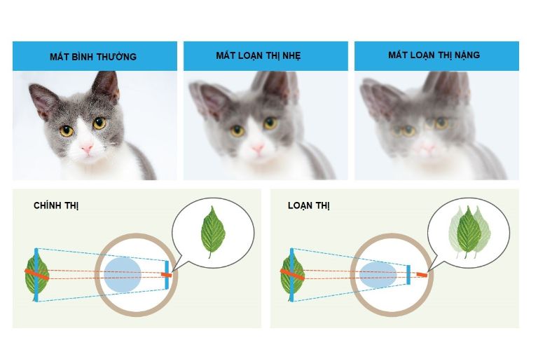 Nhận biết 4 dấu hiệu loạn thị, đâu là triệu chứng nặng?