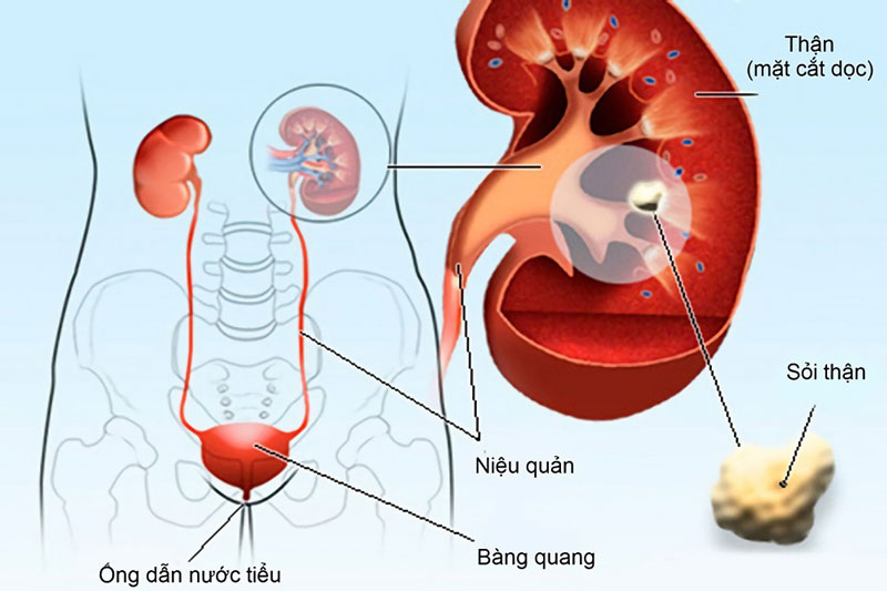 Giới thiệu một số cách chữa đi tiểu nhiều lần ở phụ nữ