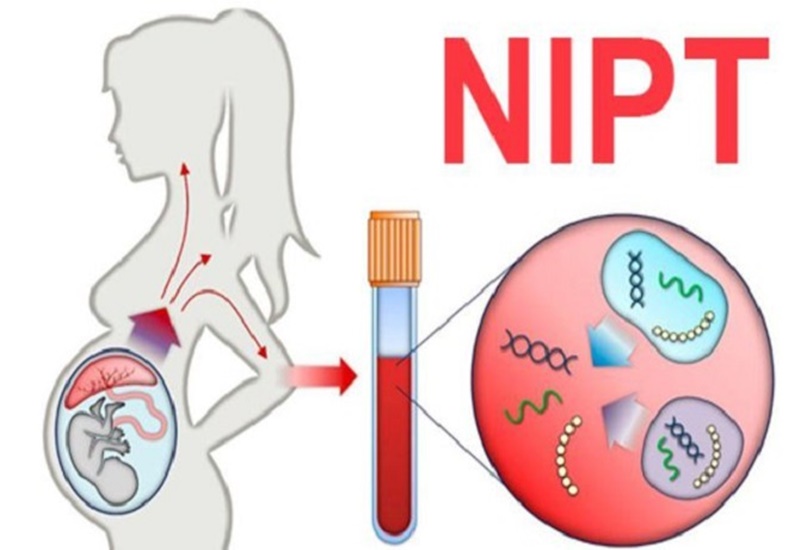 Khi nào cần làm xét nghiệm NIPT? Nên lựa chọn bệnh viện nào?