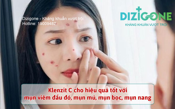 Gel trị mụn Klenzit C: 6 điều cần biết để sử dụng hiệu quả