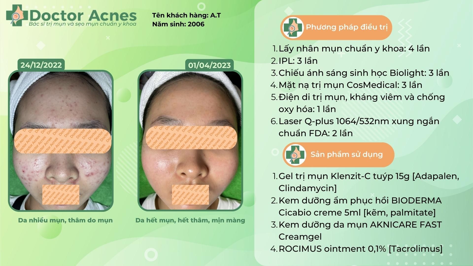 Thuốc trị mụn Klenzit C: công dụng và cách dùng