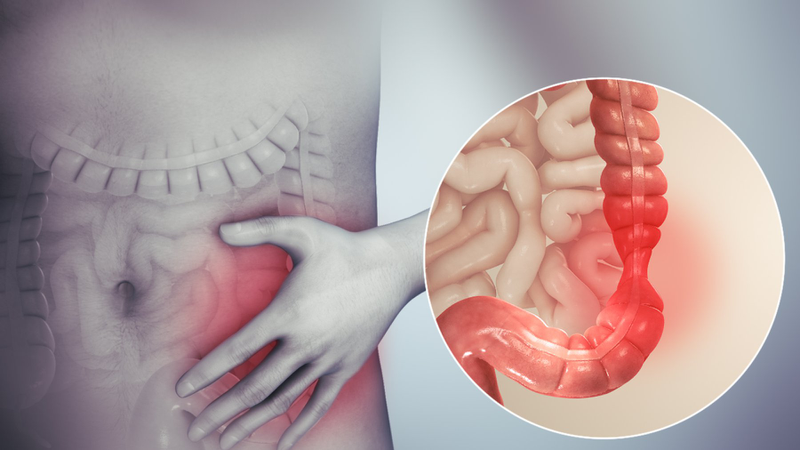 Đau bụng dưới ở nữ là biểu hiện của bệnh lý nào?